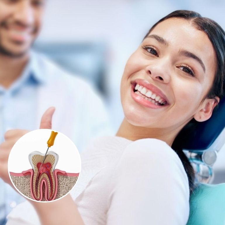 Root Canal Treatment