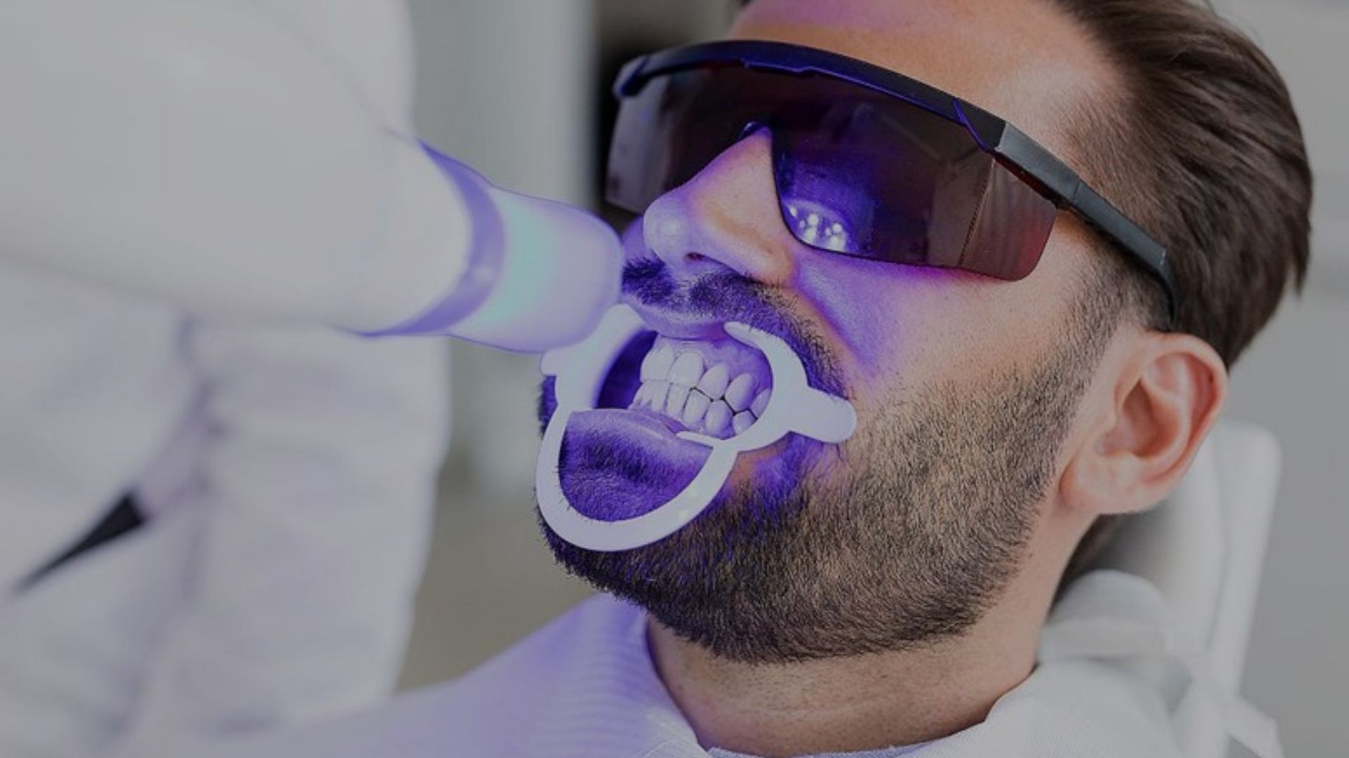Teeth Whitening
